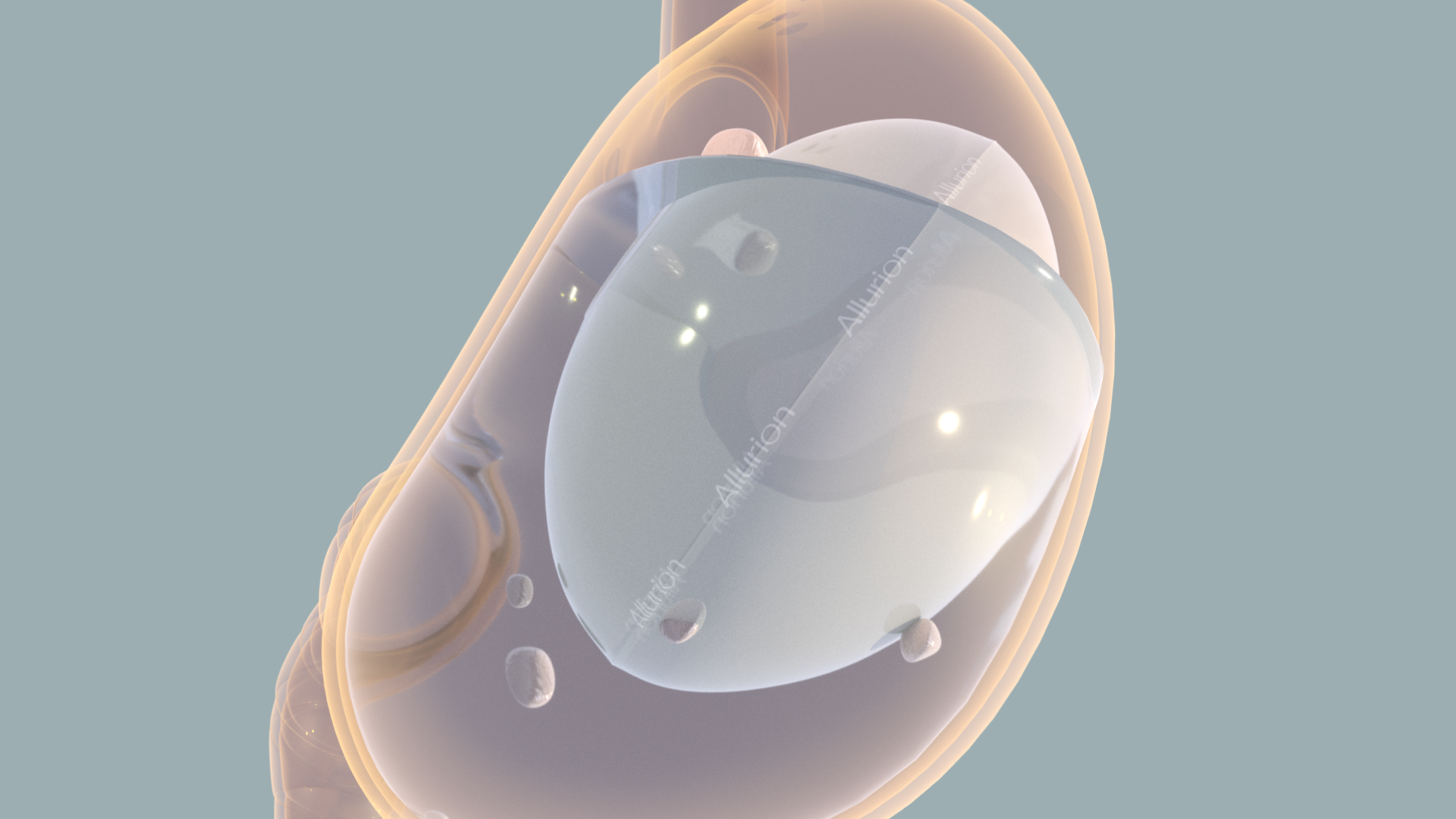 Allurion Gastric Balloon Weight Loss Without Surgery Allurion